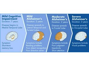 A Next-generation Approach To Alzheimer’s Treatment